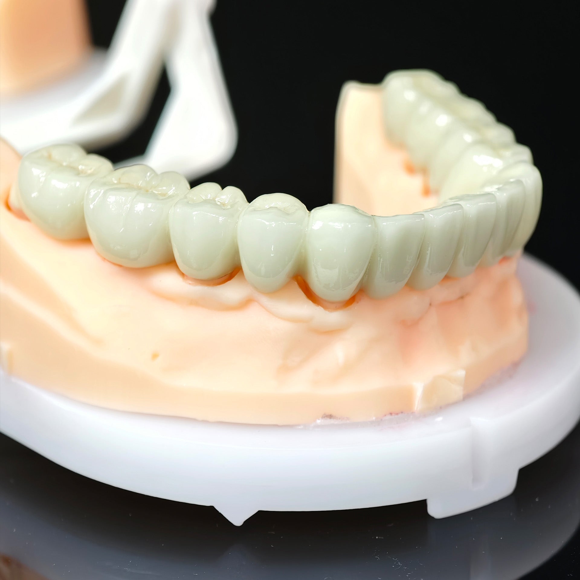 Co - Cr PFM Dental Bridge