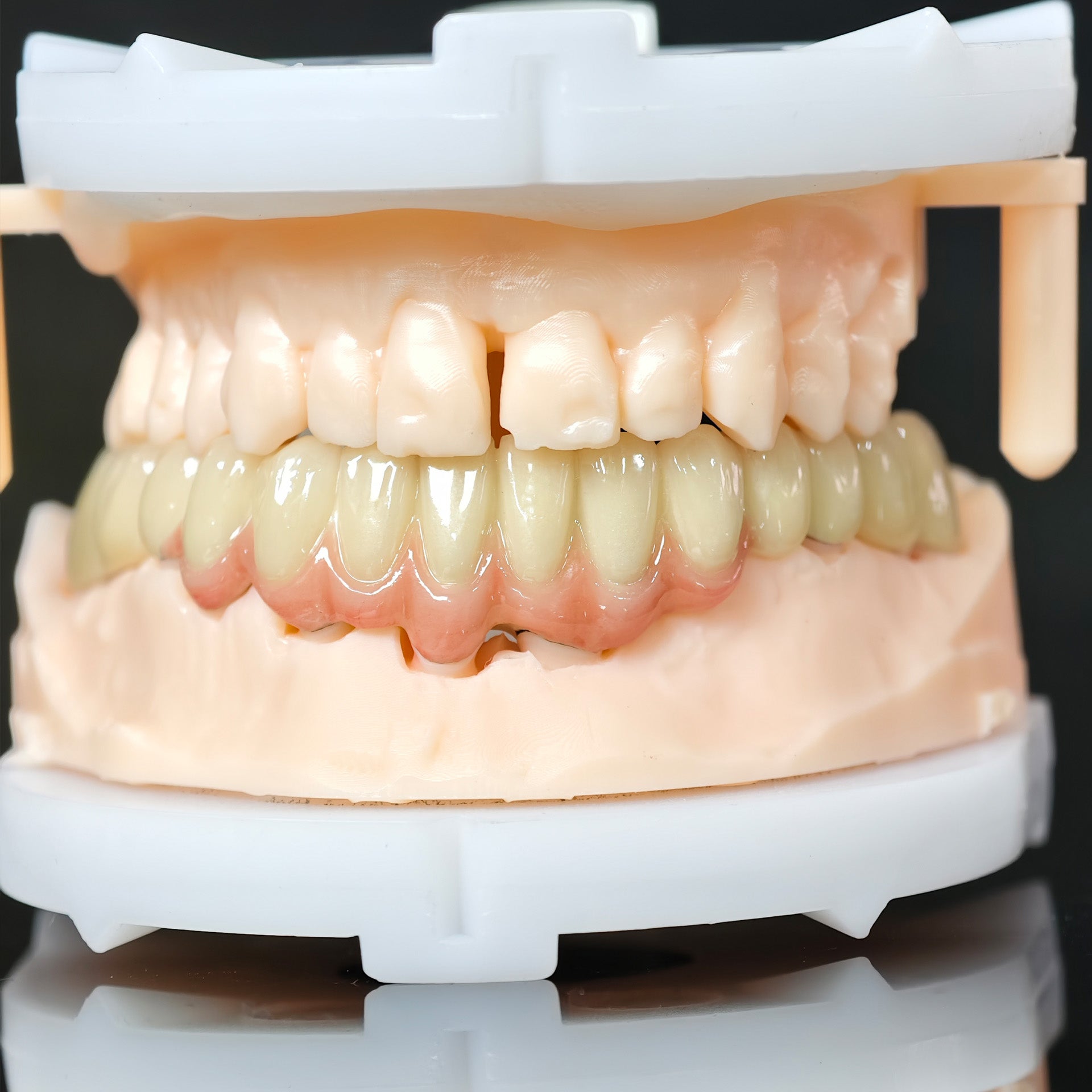 Co - Cr PFM Dental Bridge