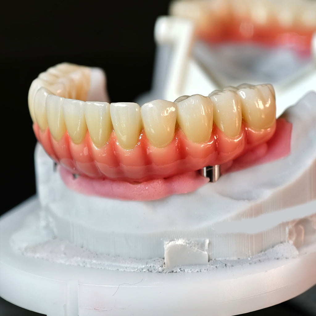 Enhanced Zirconia Crown Malo Bridge