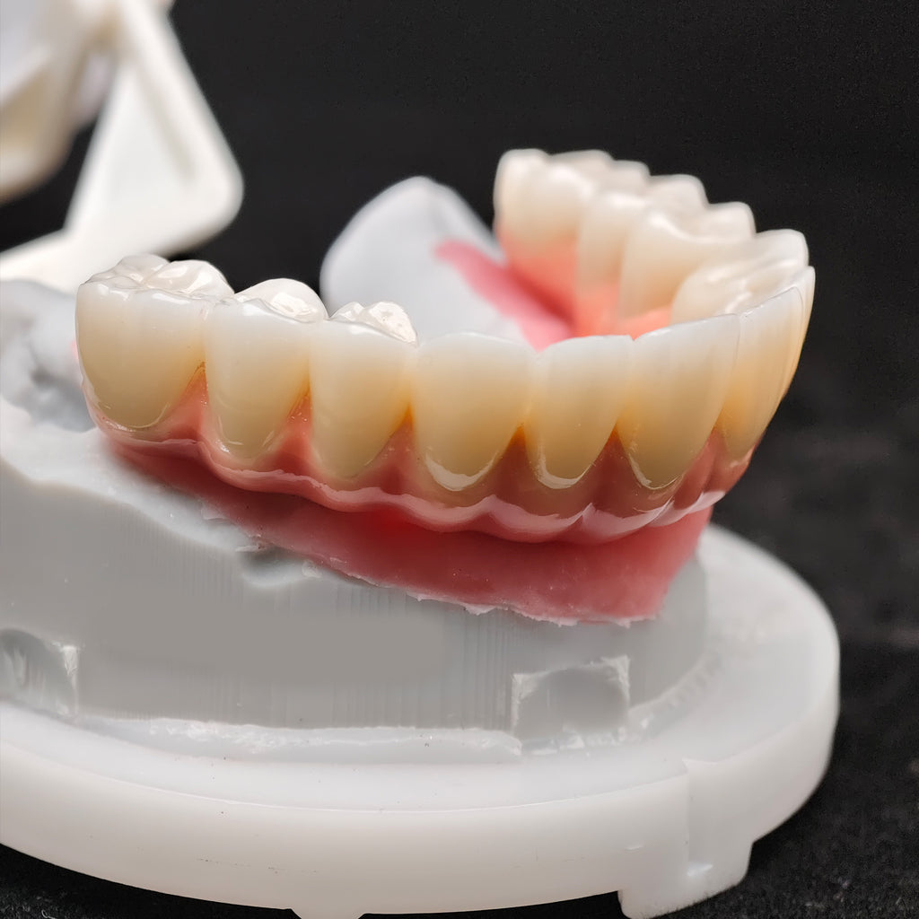 Enhanced Zirconia Crown Malo Bridge