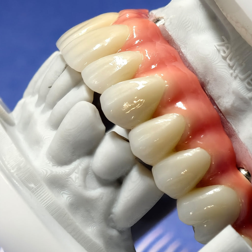Enhanced Zirconia Crown Malo Bridge