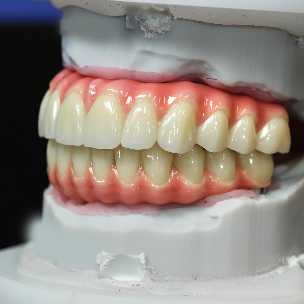 Enhanced Zirconia Crown Malo Bridge