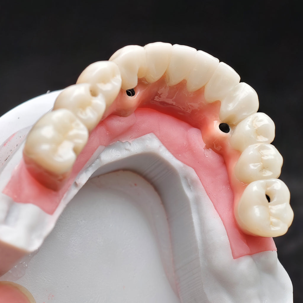 Enhanced Zirconia Crown Malo Bridge