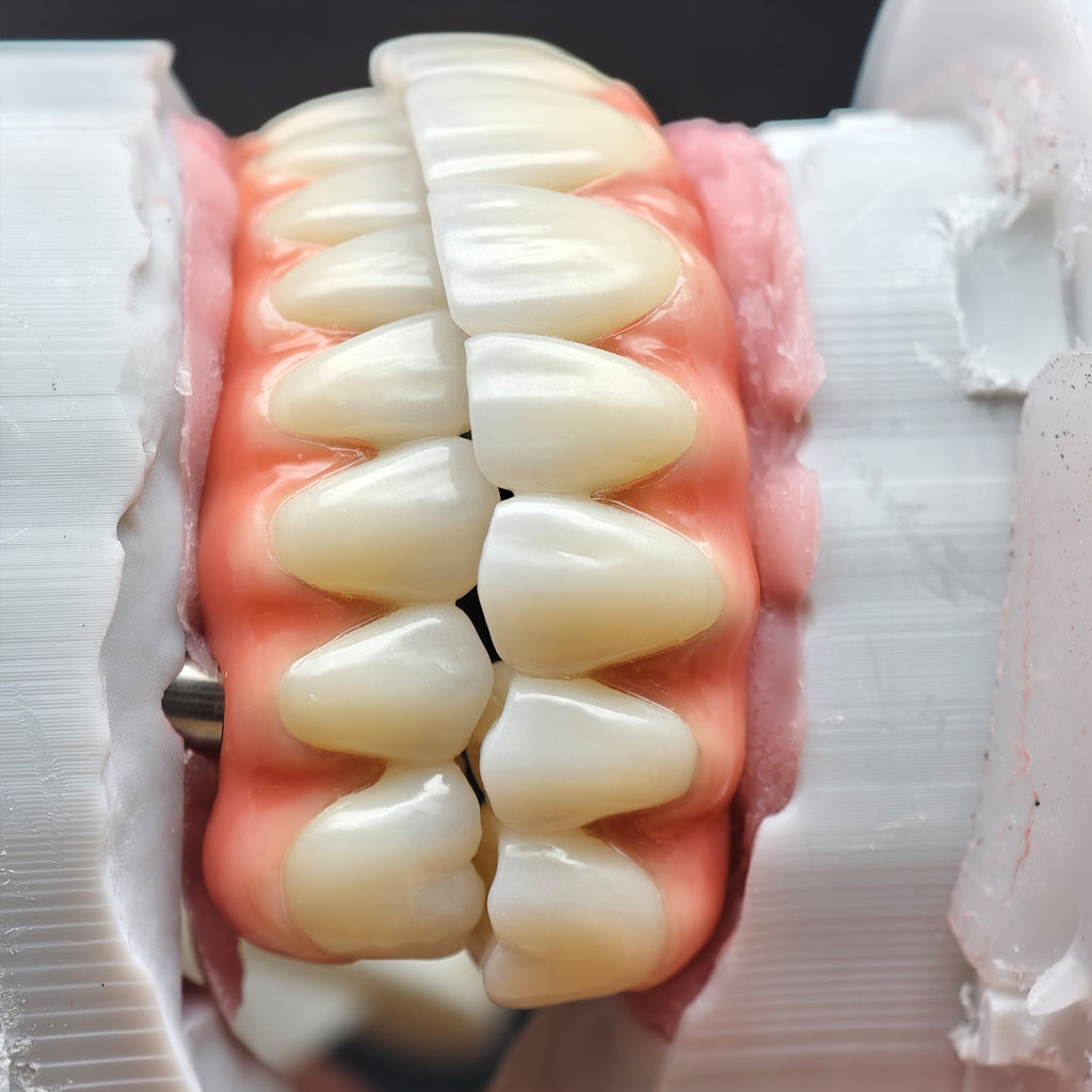 Enhanced Zirconia Crown Malo Bridge