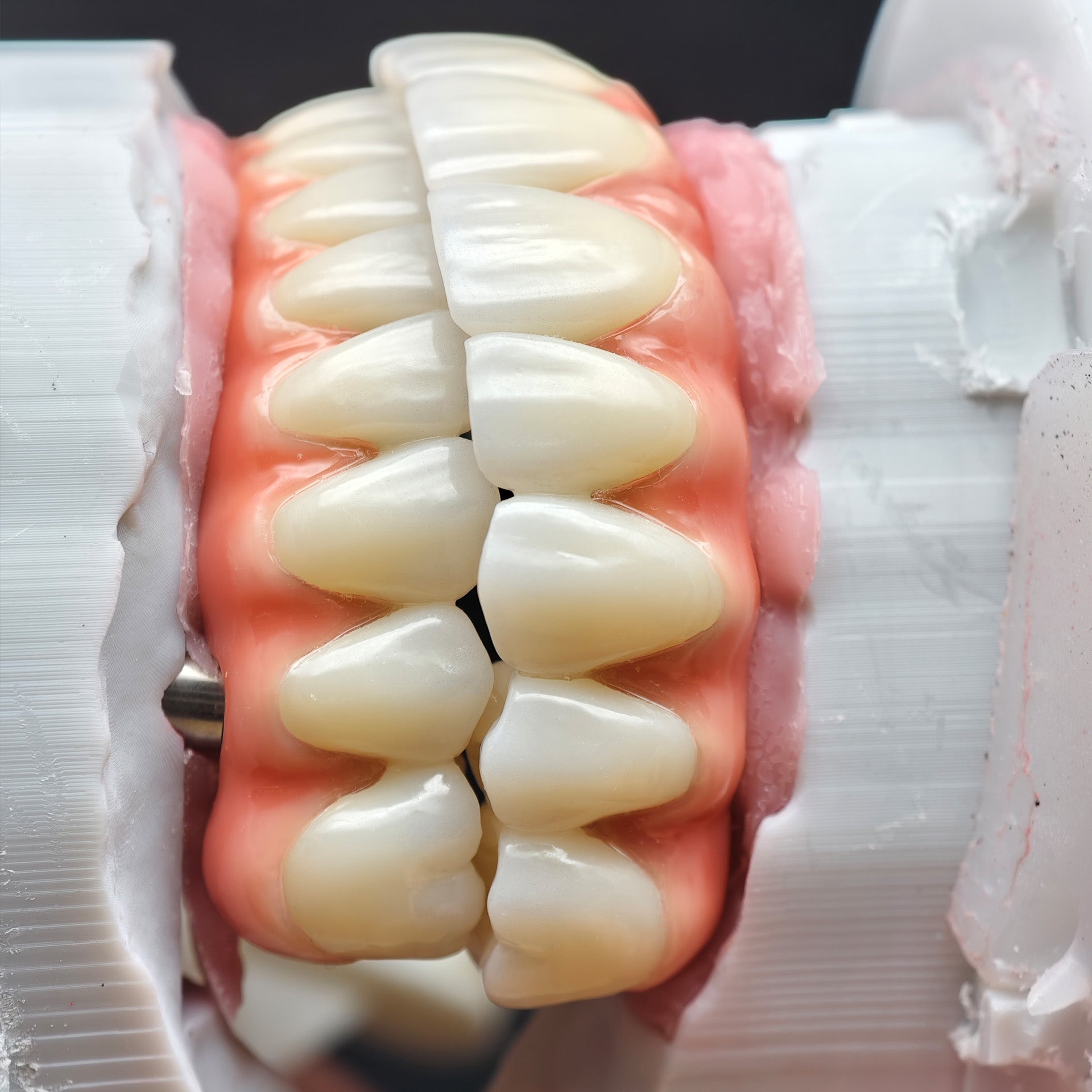 Enhanced Zirconia Crown Malo Bridge