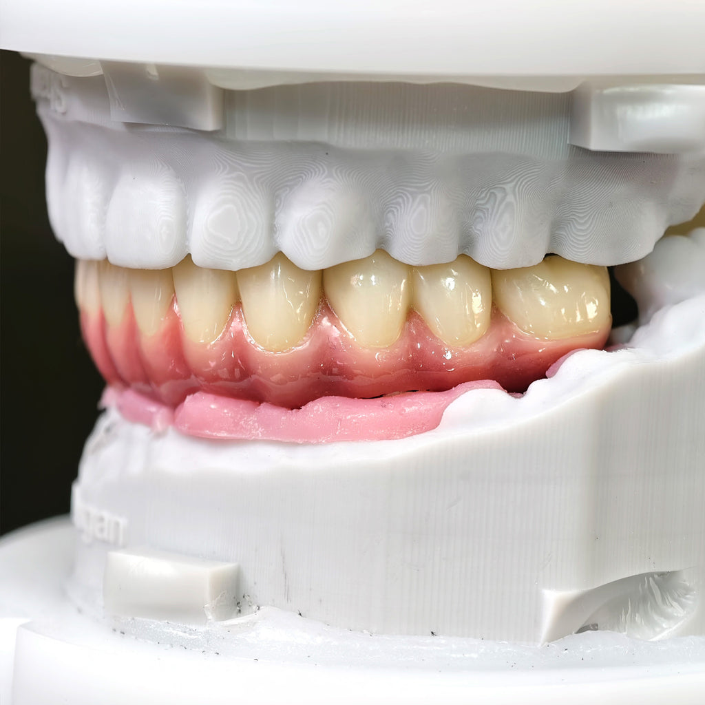 Enhanced Zirconia Crown Malo Bridge