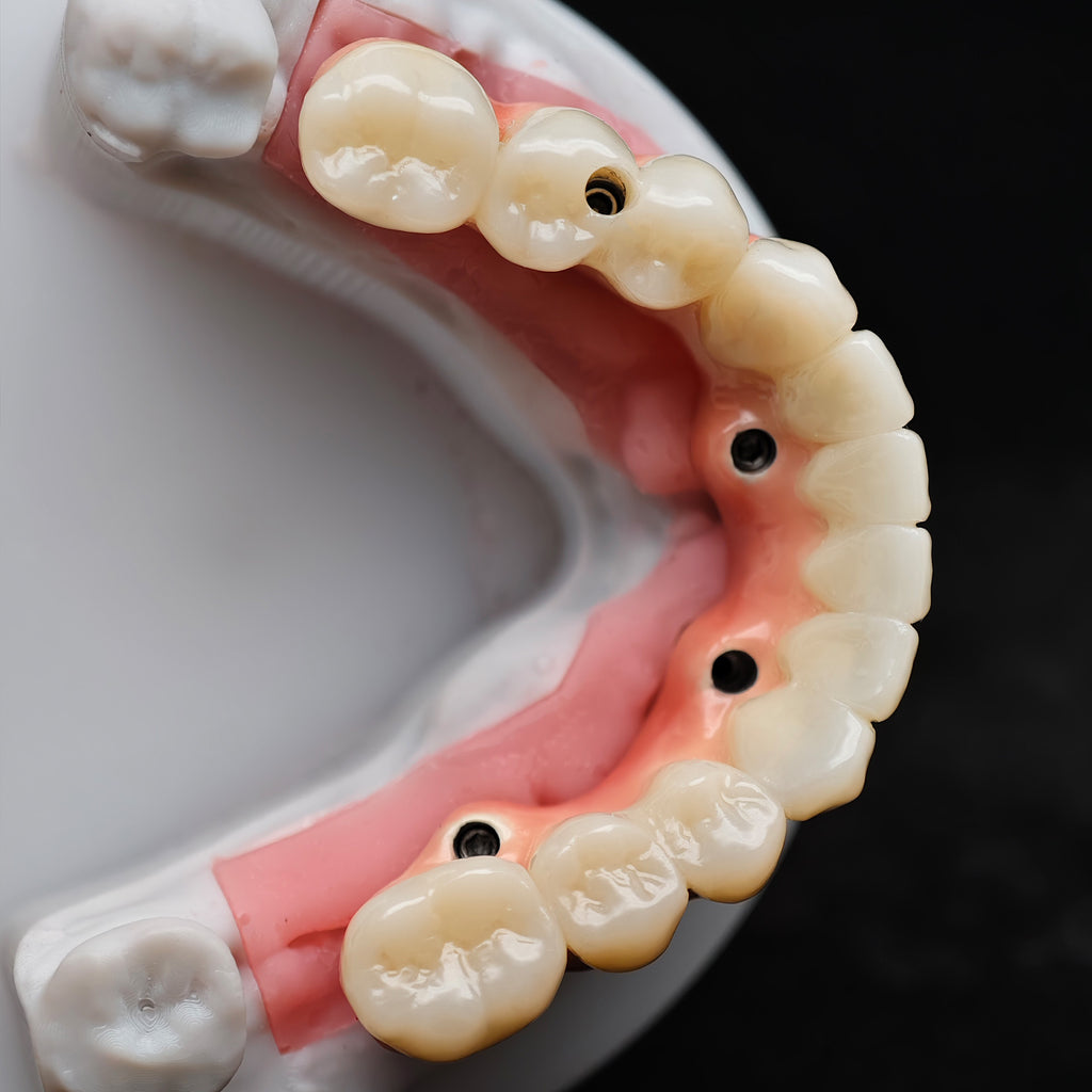 Enhanced Zirconia Crown Malo Bridge