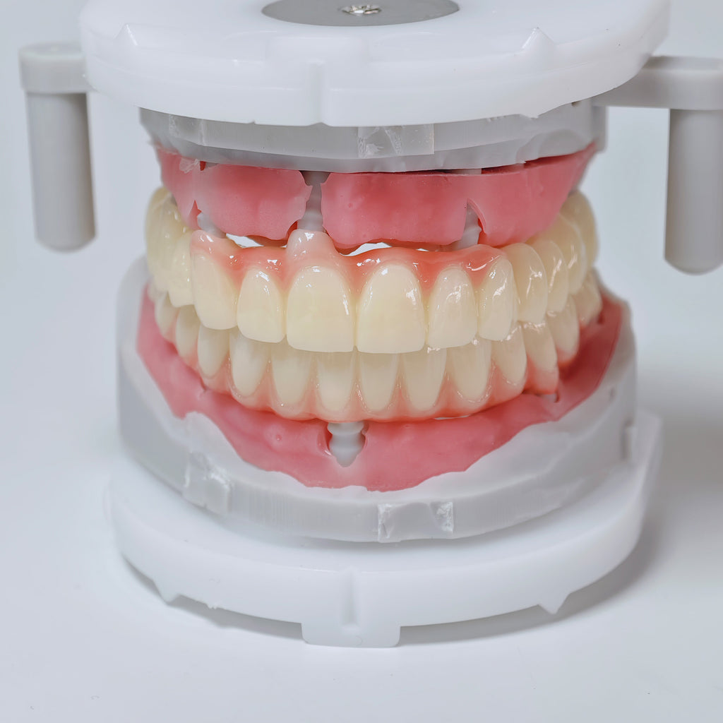 Full-Arch Zirconia Bridge And PMMA Bridge With Cement Retained