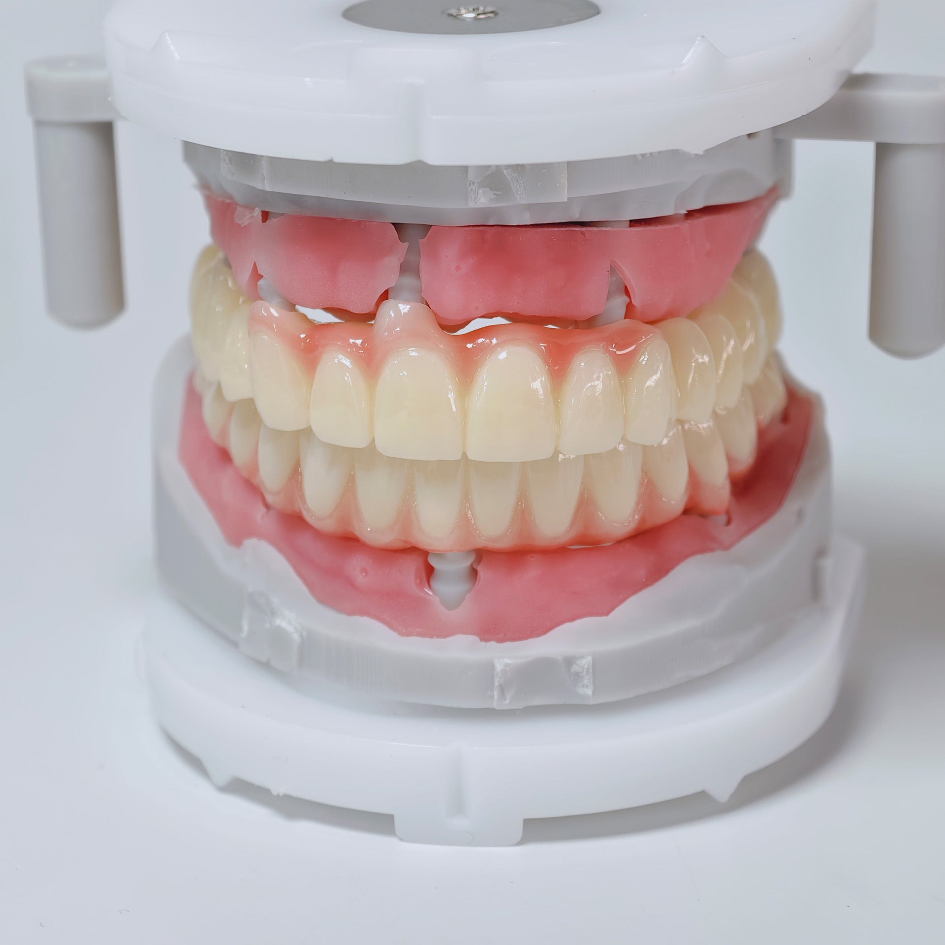 Full-Arch Zirconia Bridge And PMMA Bridge With Cement Retained