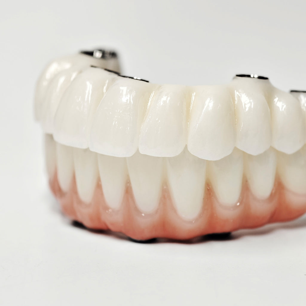 Full-Arch Zirconia Bridge With Ti-Base Abutment