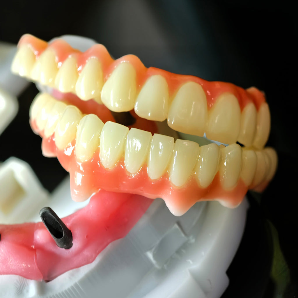 Full=Arch Pmma Bridge With Cement Retained