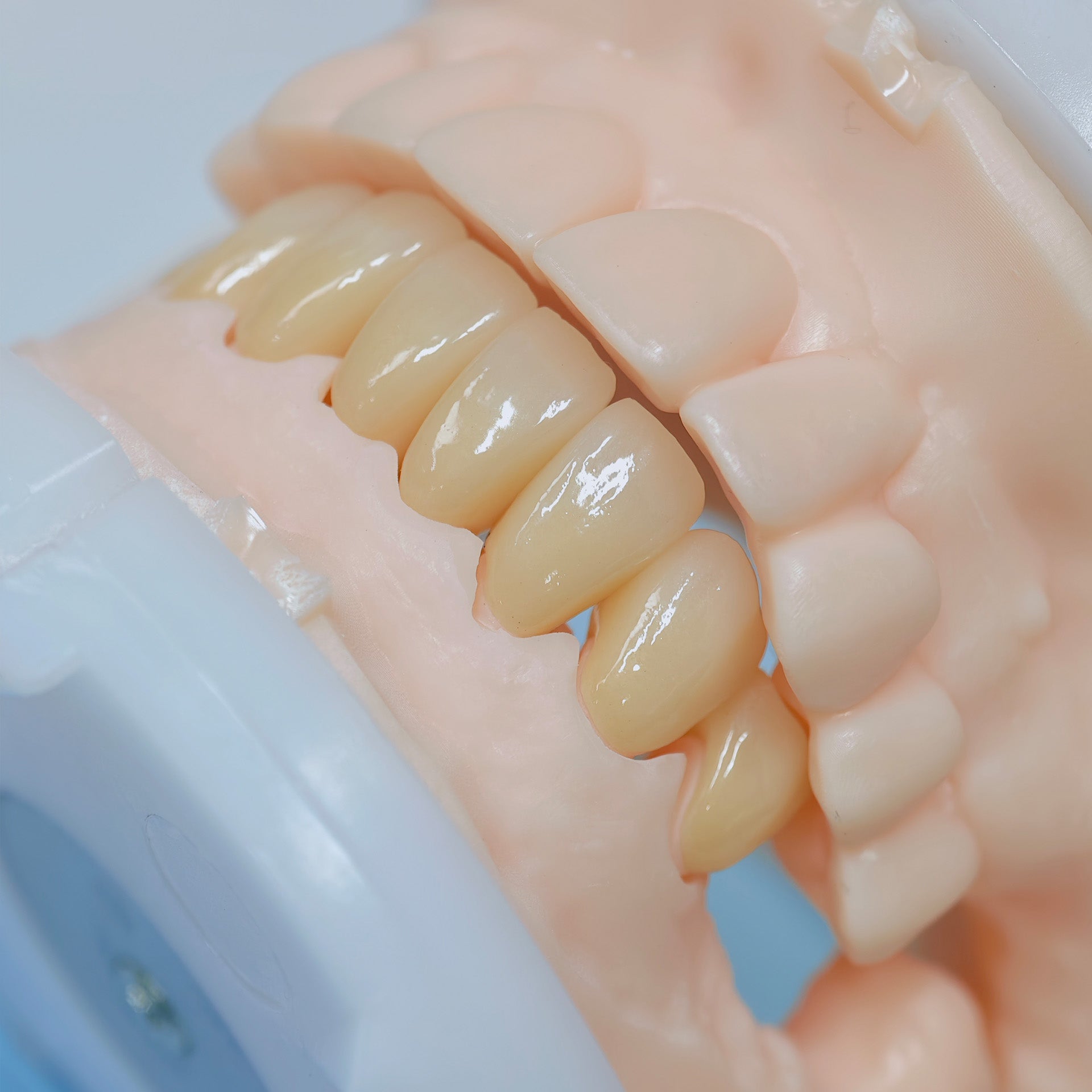 High - Strength Zirconia Crowns