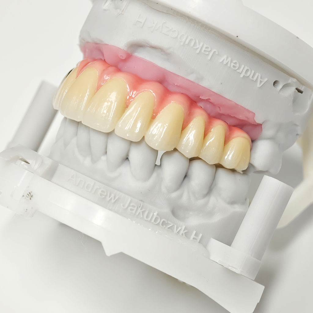 Malo Bridge With Gold-Plated Titanium Framework And A Gold Crown