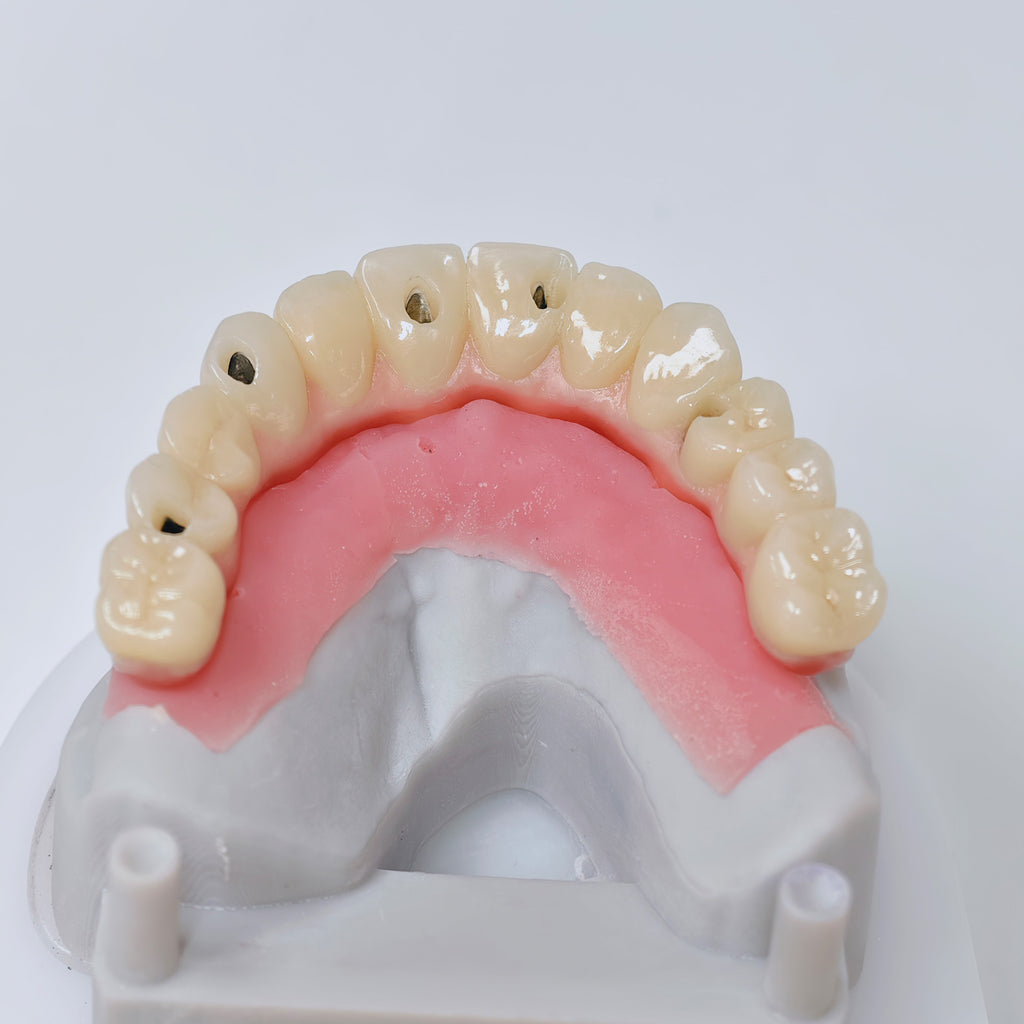 Malo Bridge With Screw-Retained