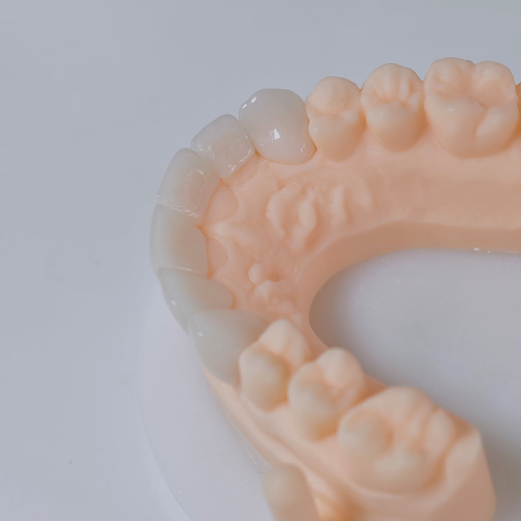 PFZ Porcelain Fused Zirconia Aidite Zirconia