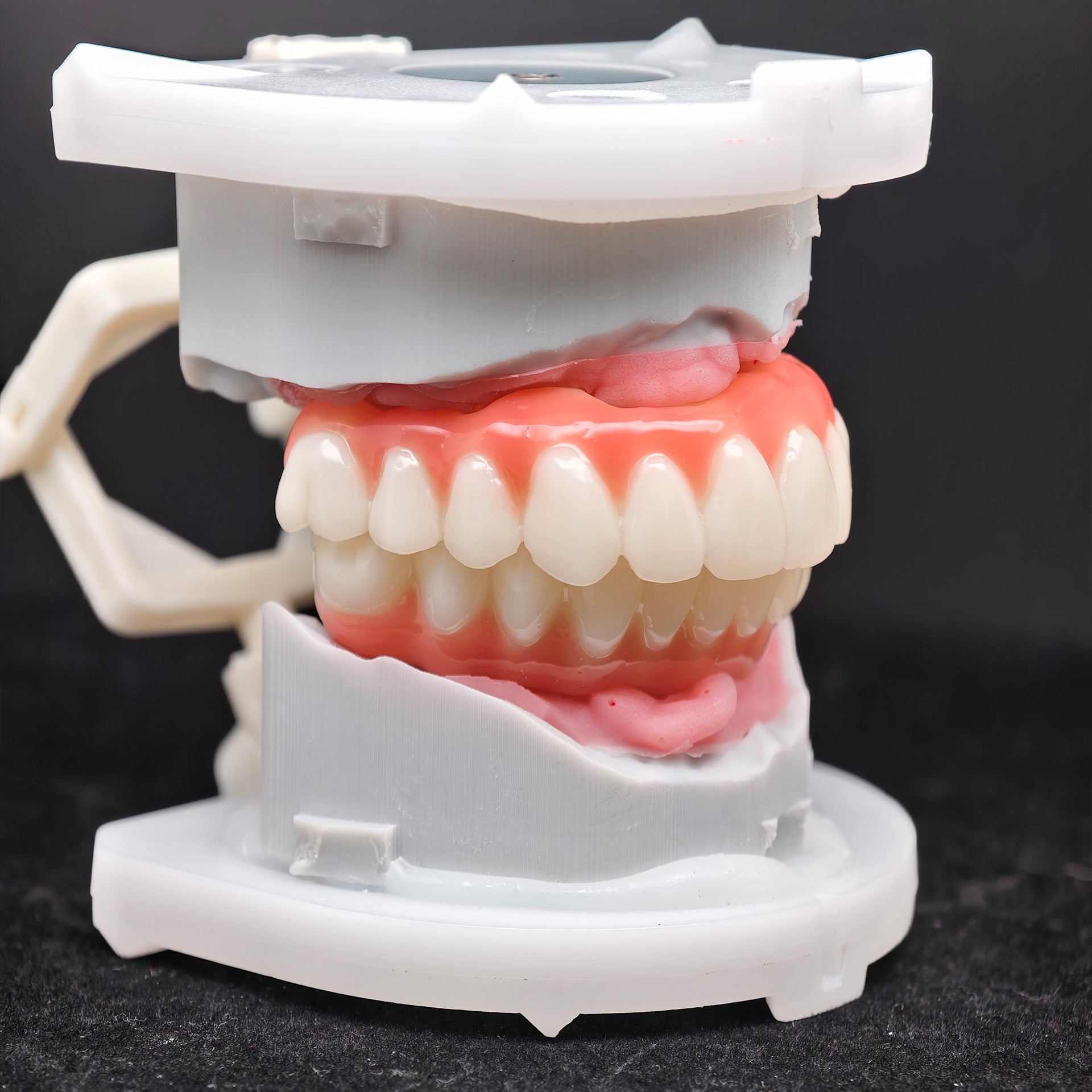 PMMA Bridge With Ti-Base Screw Retained Trying For Full Arch Restoration