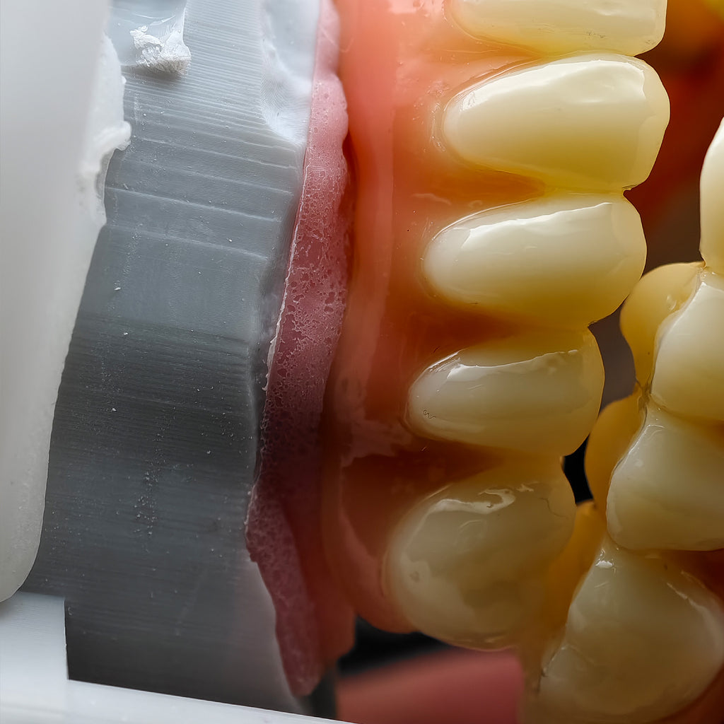 PMMA Bridge With Ti-Base Screw Retained Trying For Full Arch Restoration