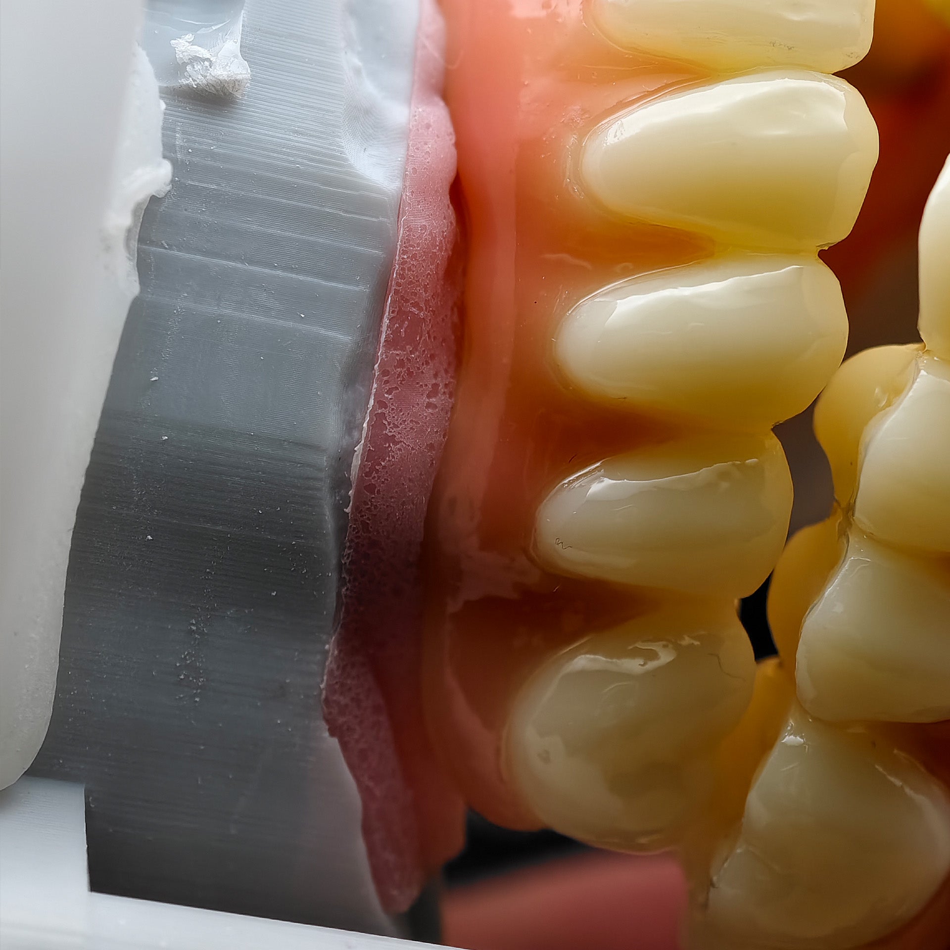 PMMA Bridge With Ti-Base Screw Retained Trying For Full Arch Restoration