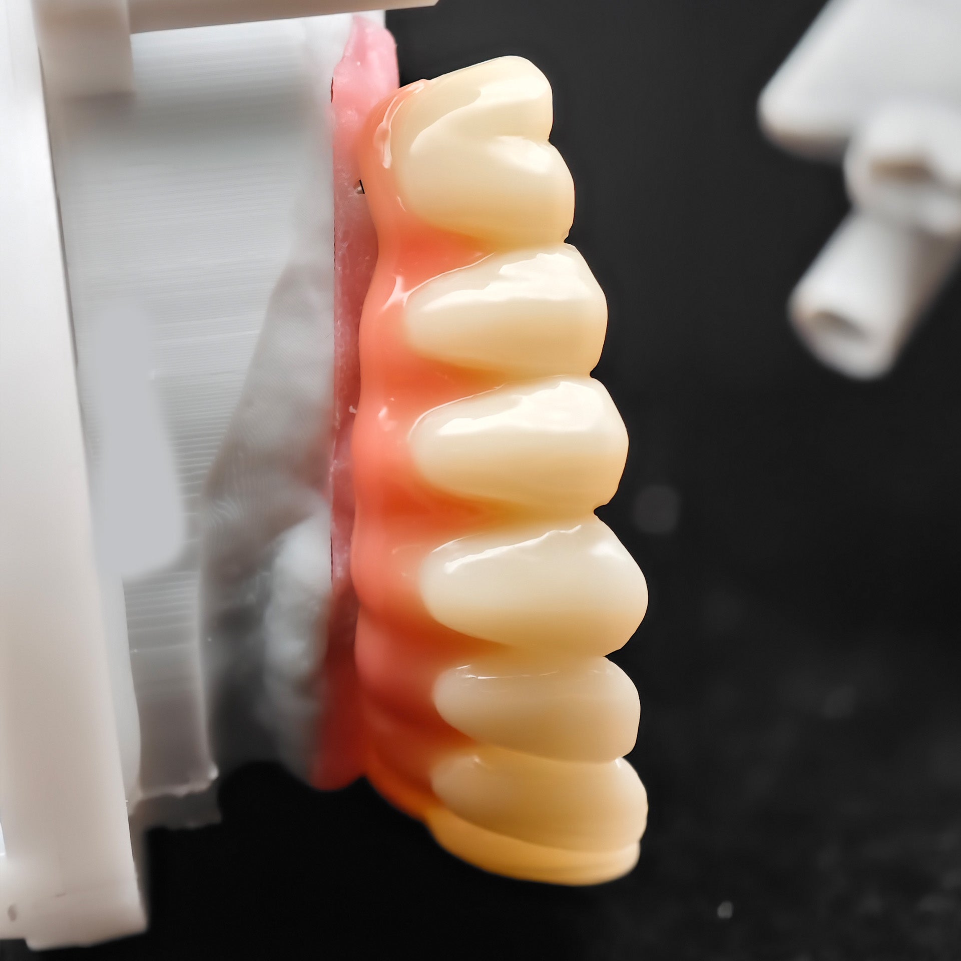 PMMA Bridge With Ti-Base Screw Retained Trying For Full Arch Restoration