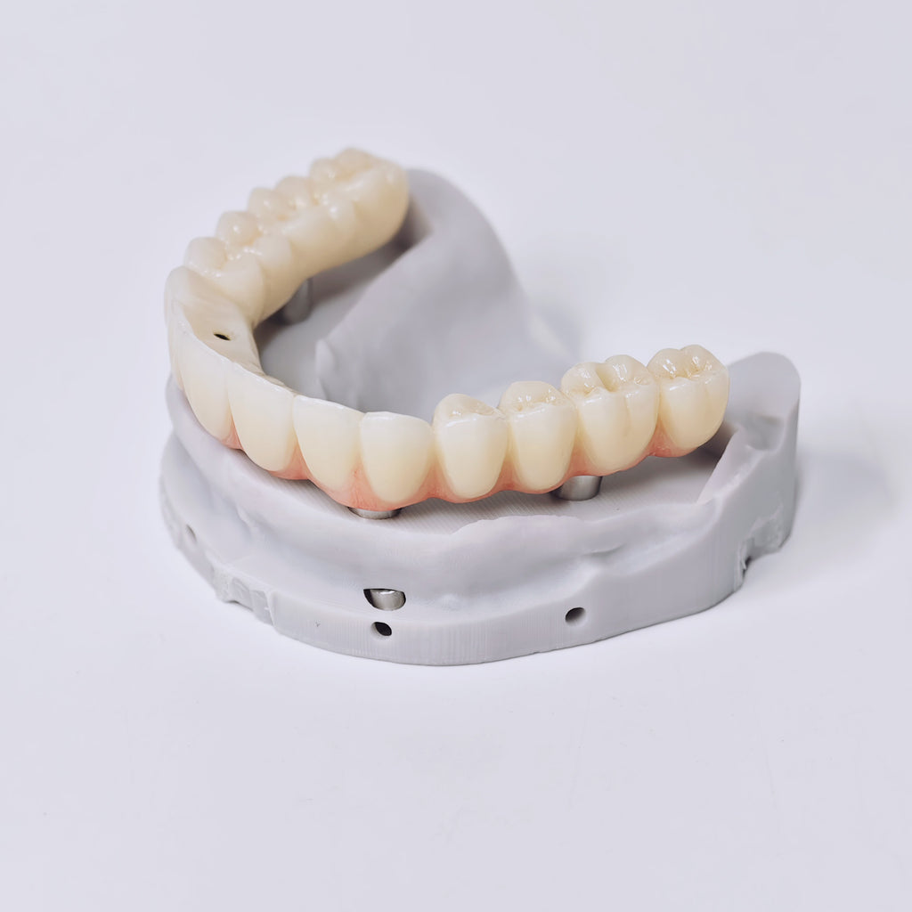 Ti-Bar Titanium Gold-Plated Metal Frame With Zirconia Bridge And Screw Retained