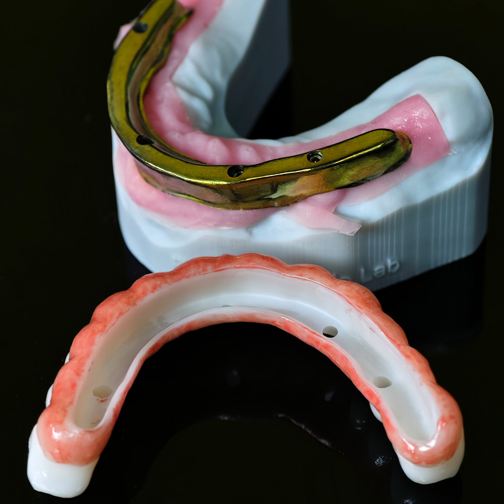 Ti-Bar Titanium Nitride Metal Frame With Zirconia Bridge For Full Arch Restoration