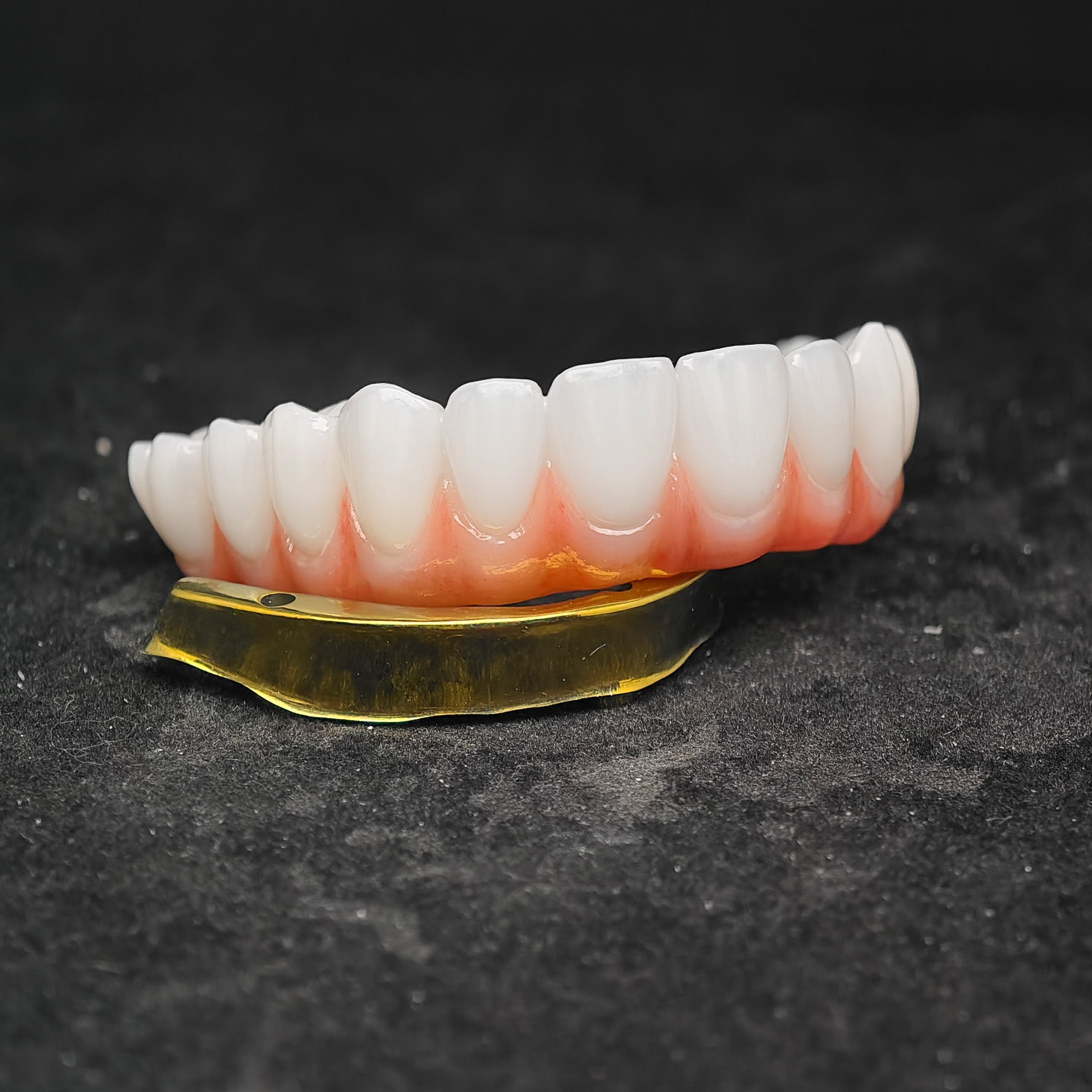 Ti-Bar Titanium Nitride Metal Frame With Zirconia Bridge For Full Arch Restoration