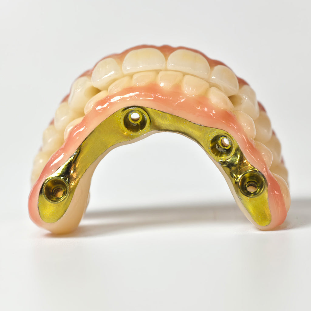 Ti-Bar Titanium Nitride Metal Frame With Zirconia Bridge For Full Arch Restoration