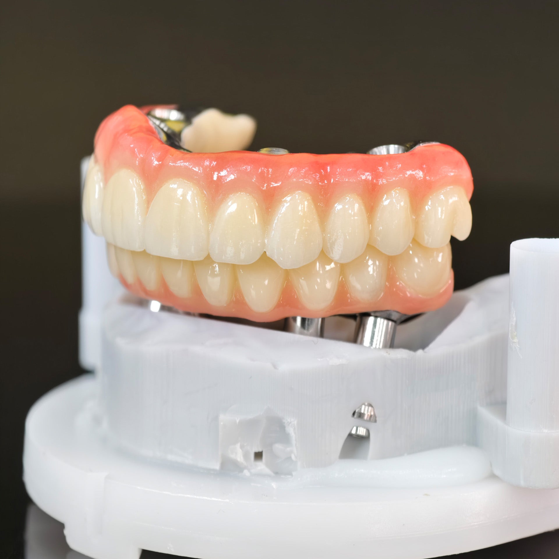 Ti-Bar Titanium Nitride Metal Frame With Zirconia Bridge For Full Arch Restoration