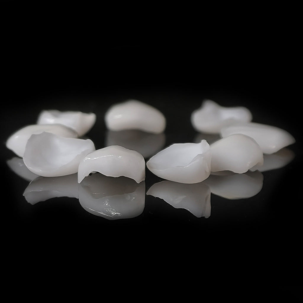 Ultra-Thin Emax Veneer. High Transparency/Translucent, Natural Shade
