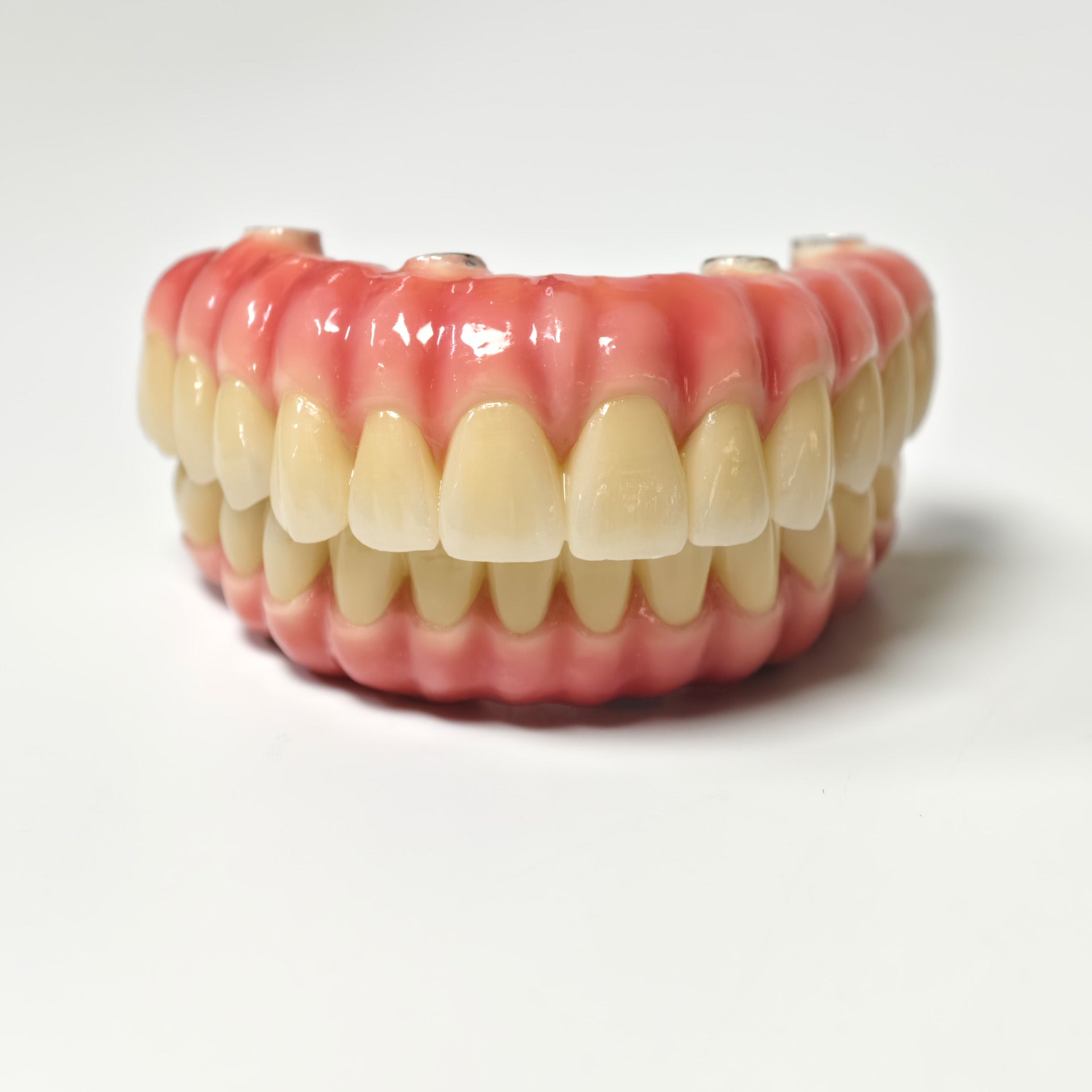Zirconia-Enamel Hybrid Malo Bridge