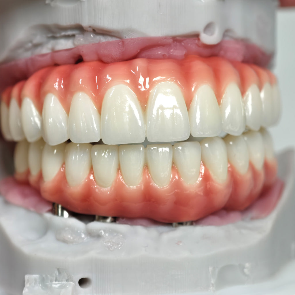 Zirconia-Enamel Hybrid Malo Bridge