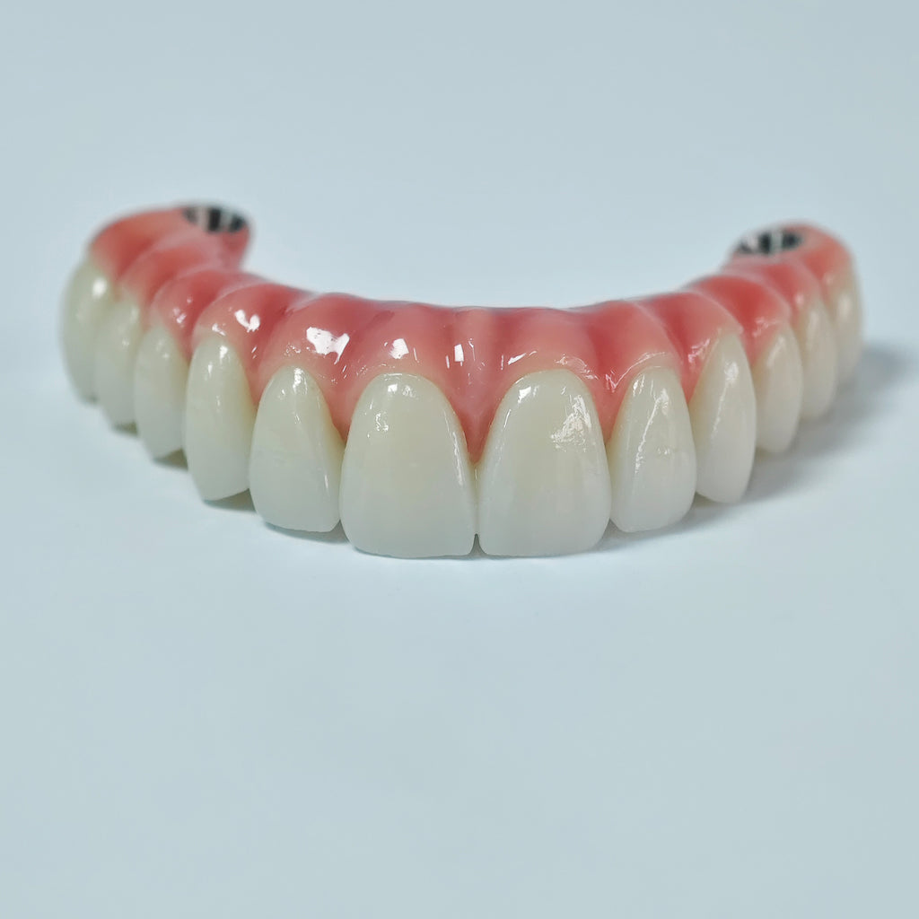 Zirconia-Enamel Hybrid Malo Bridge