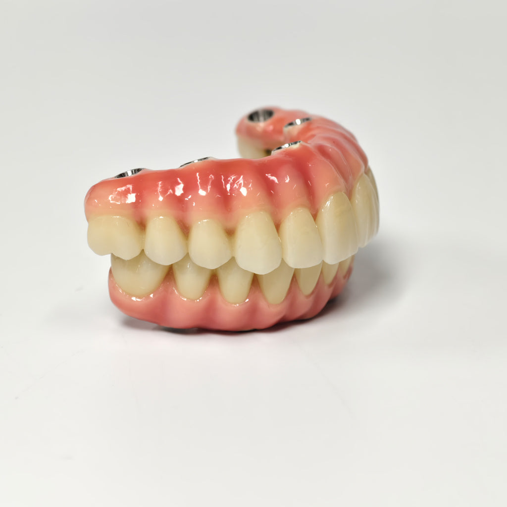Zirconia-Enamel Hybrid Malo Bridge