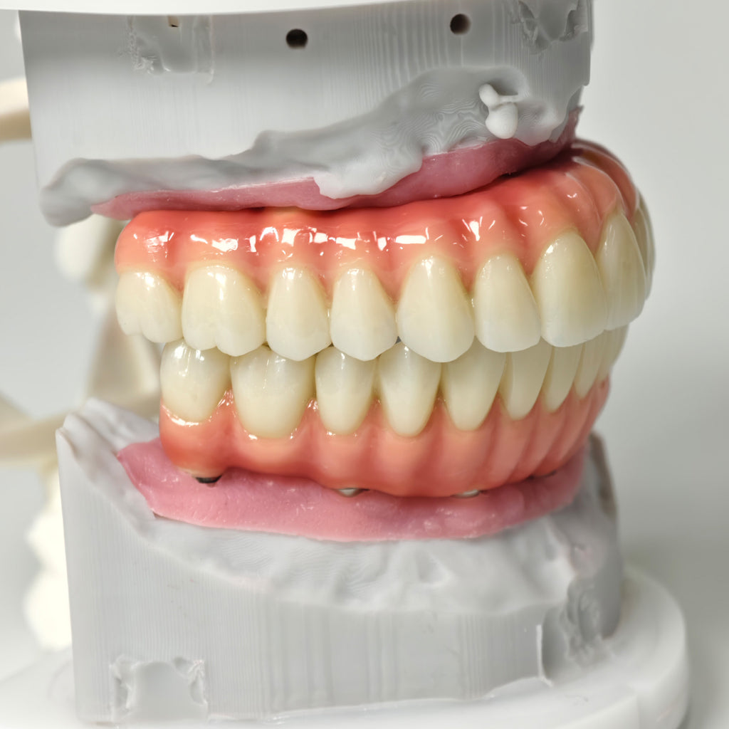 Zirconia-Enamel Hybrid Malo Bridge