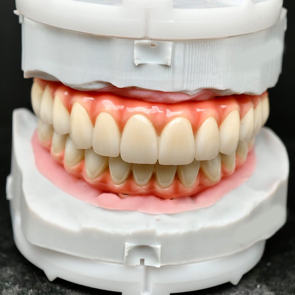Zirconia-Enamel Hybrid Malo Bridge