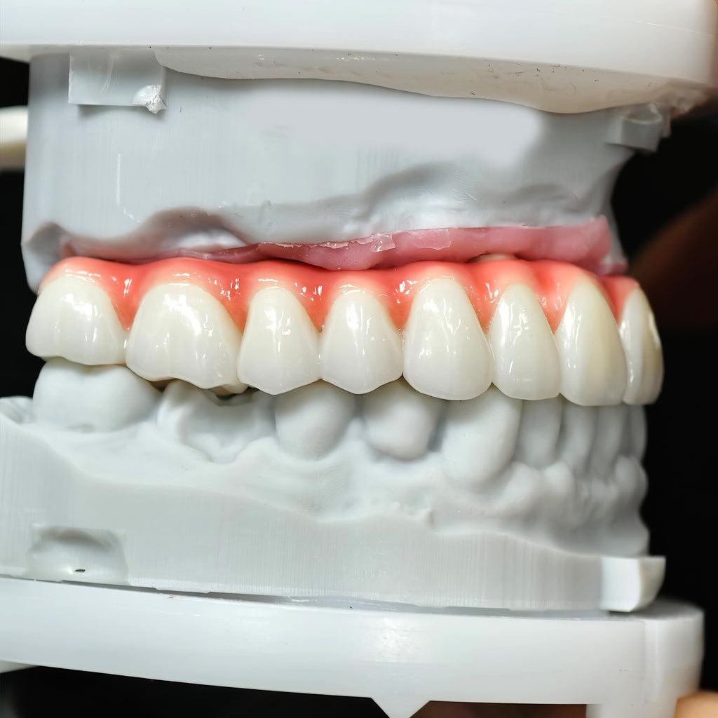 Zirconia-Enamel Hybrid Malo Bridge