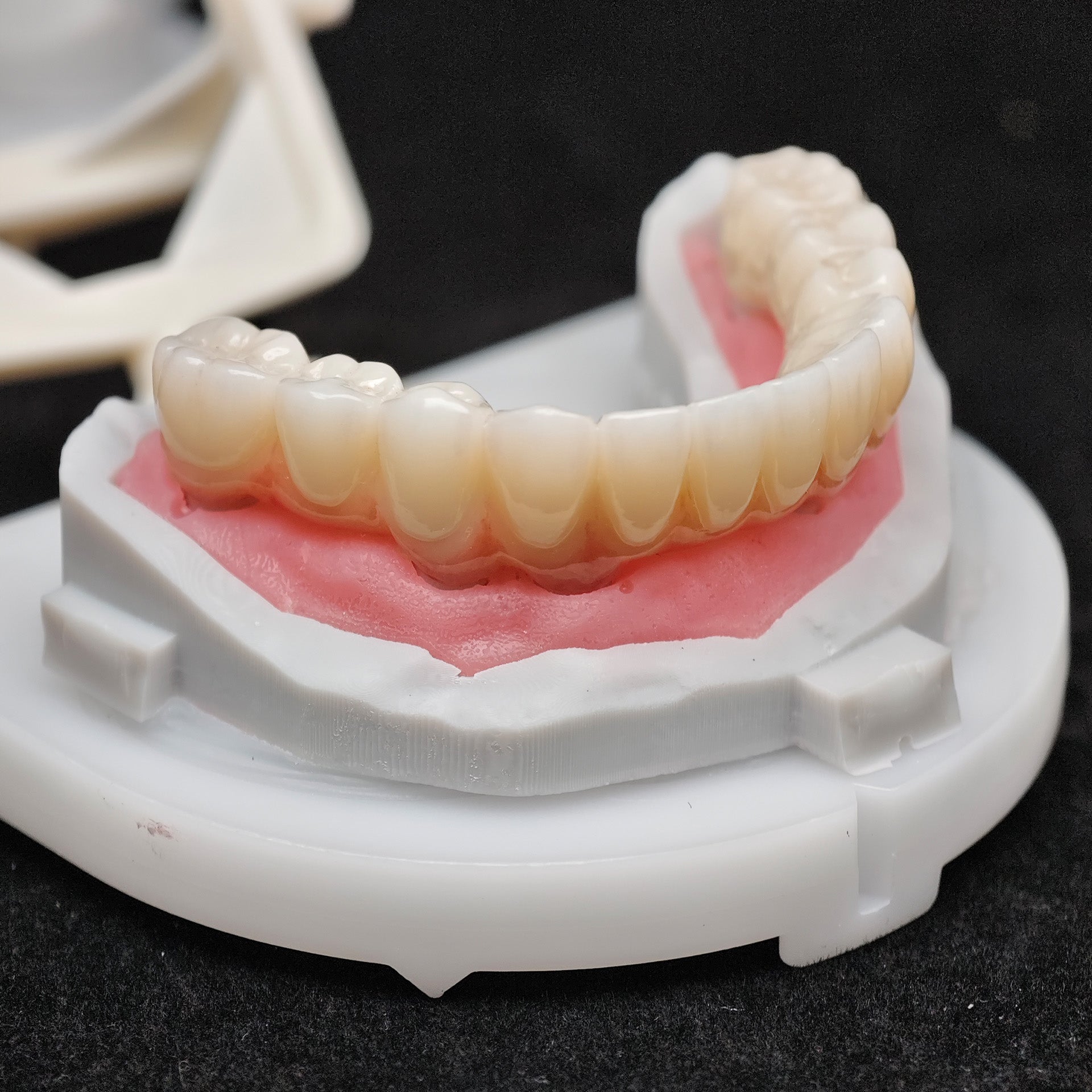 Zirconia Bridge With Cement Retained
