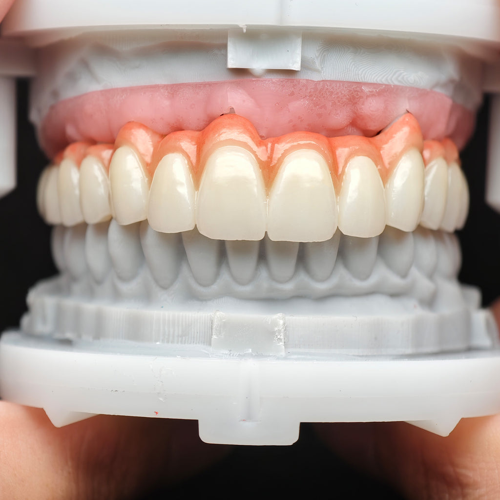 Zirconia Bridge With Cement Retained