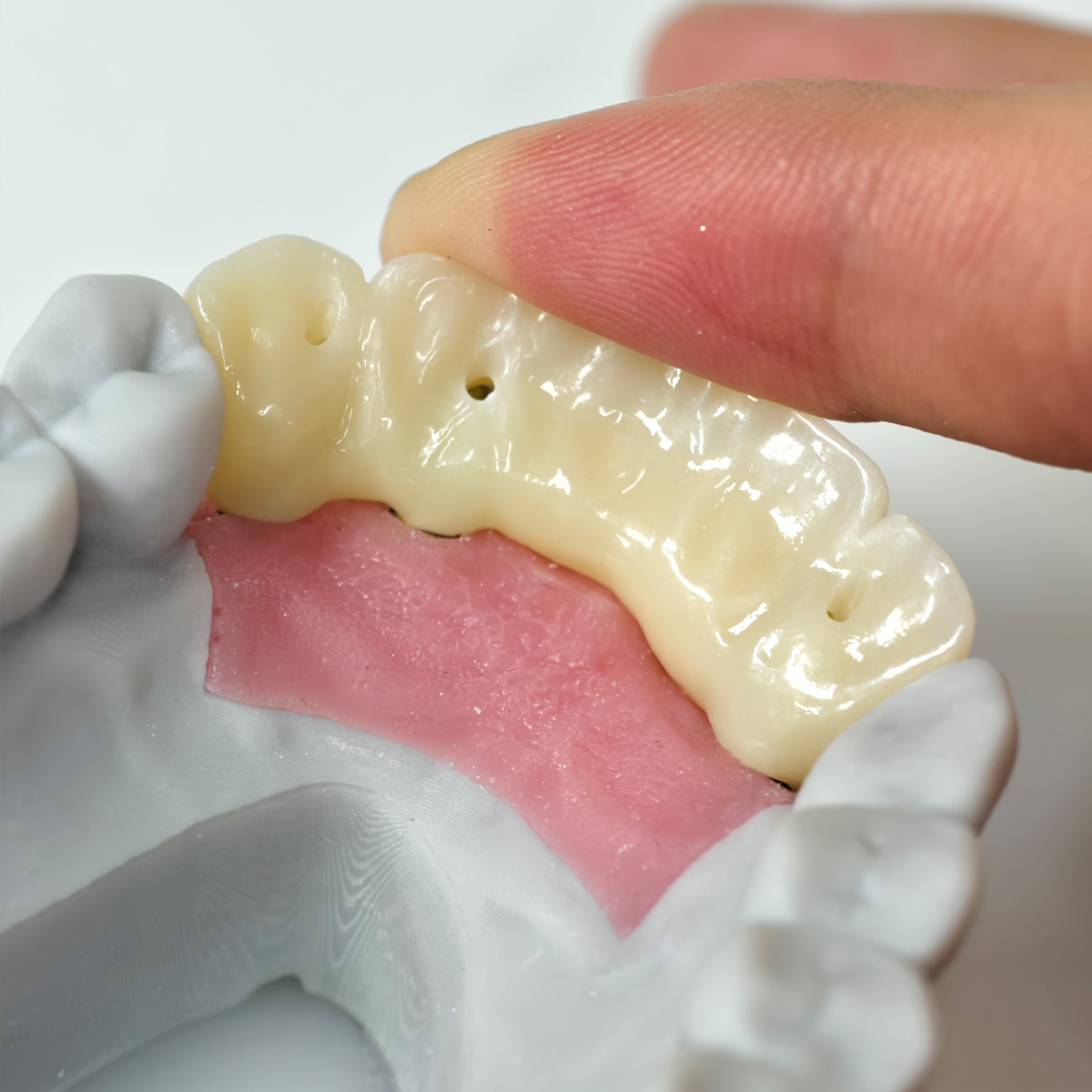 Zirconia Implant Bridge Screwmentable Dental Crown