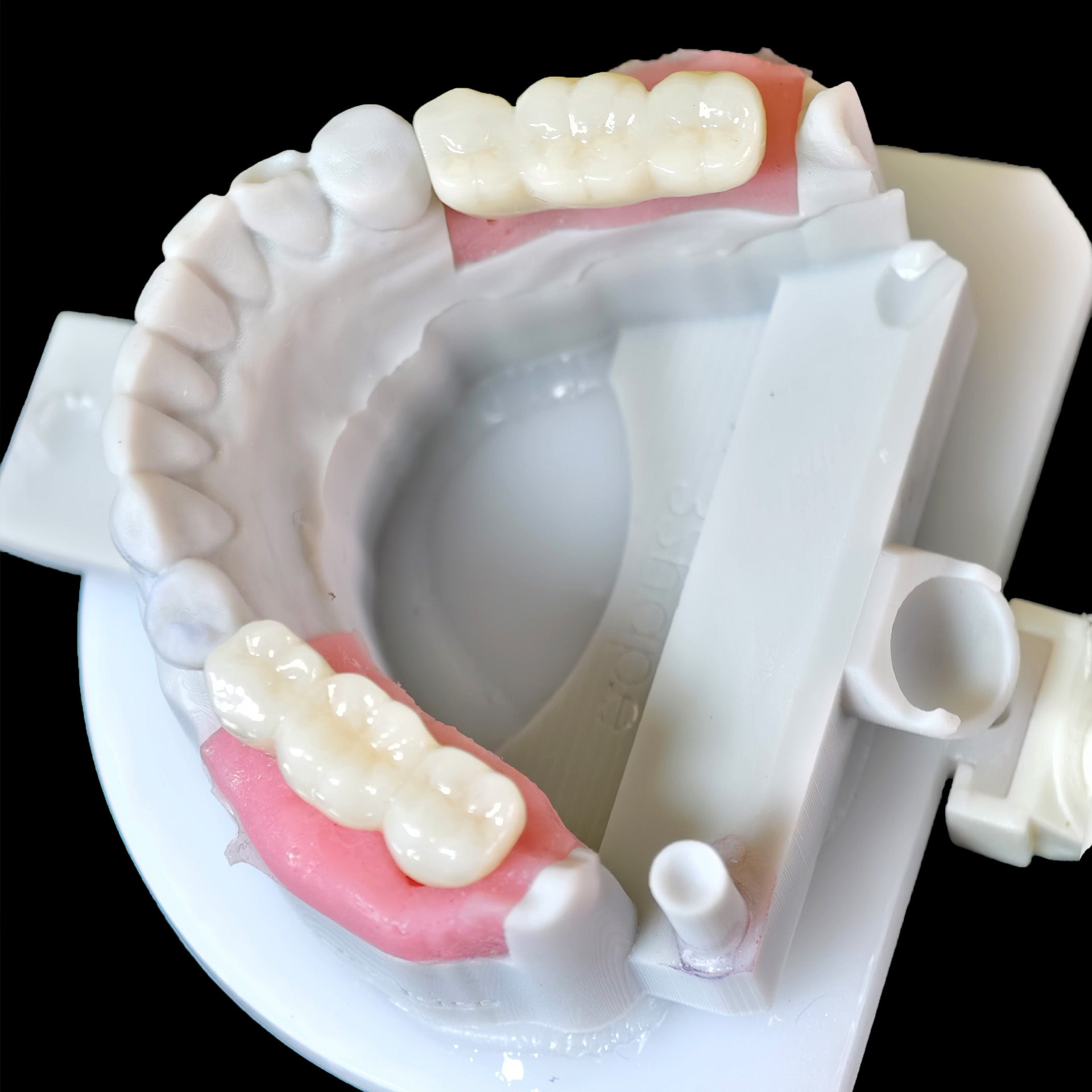 Zirconia Implant Bridge Screwmentable Dental Crown