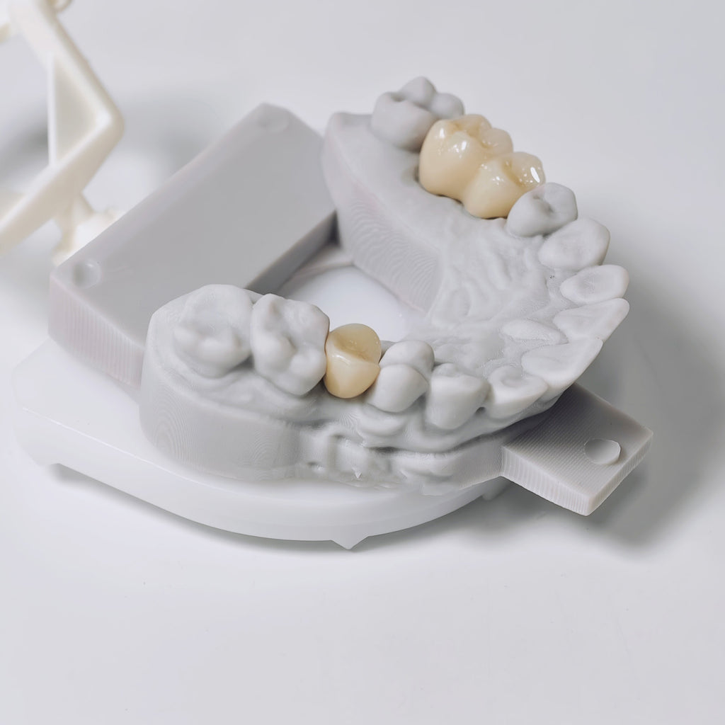 Zirconia Implant Crowns And Bridges Screwmentable Dental Crown
