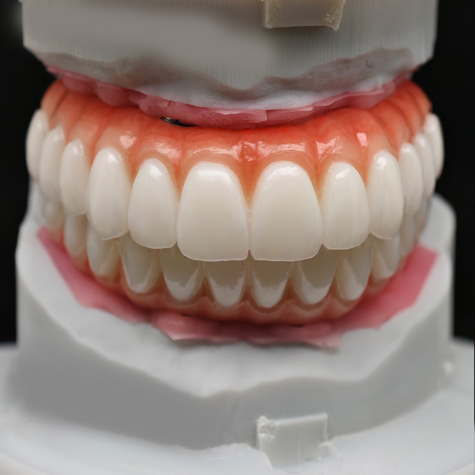 All On 4 Zirconia Bridge With Ti-Base Screw Retained Trying For Full Arch Restoration