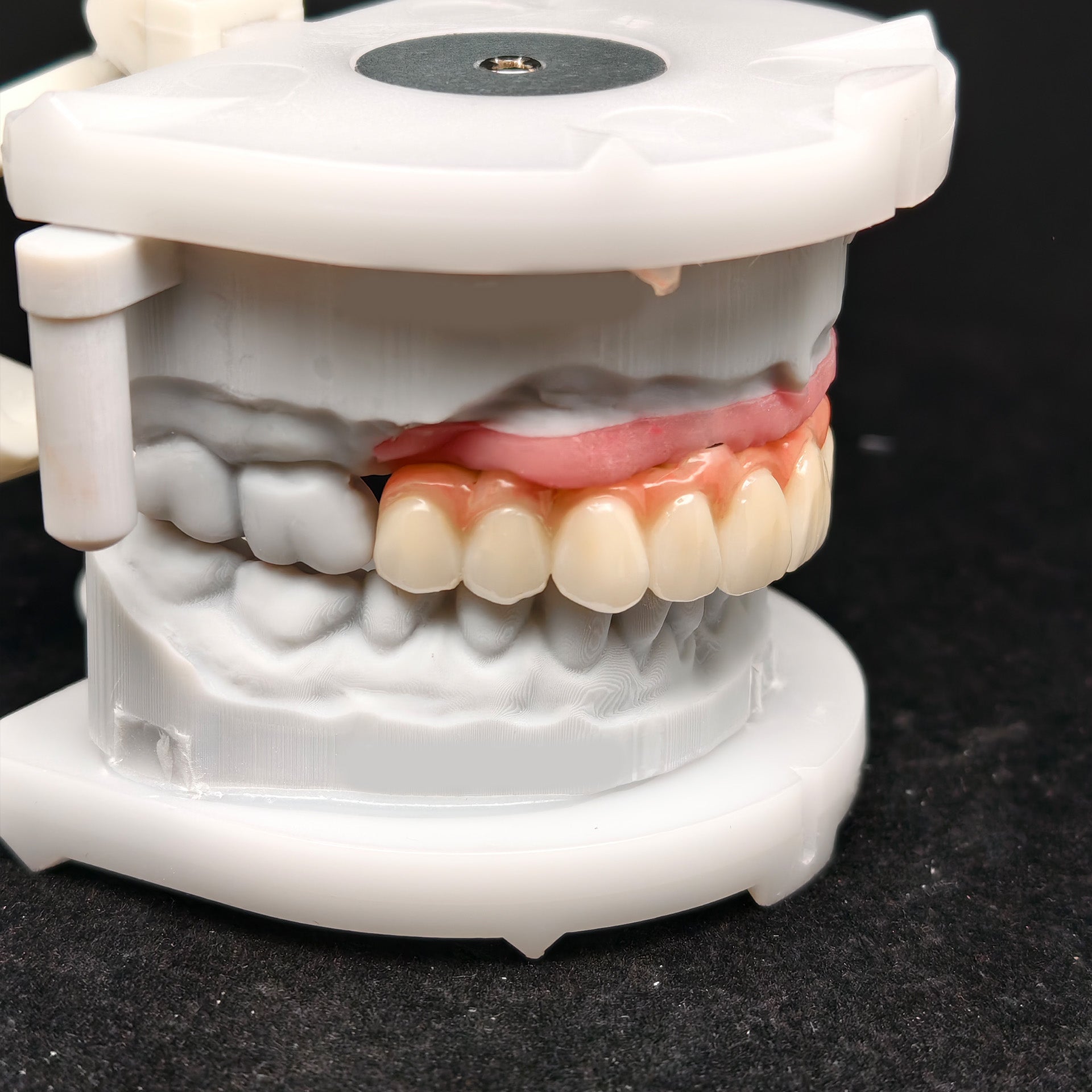 All On 4 Zirconia Bridge With Ti-Base Screw Retained Trying For Full Arch Restoration