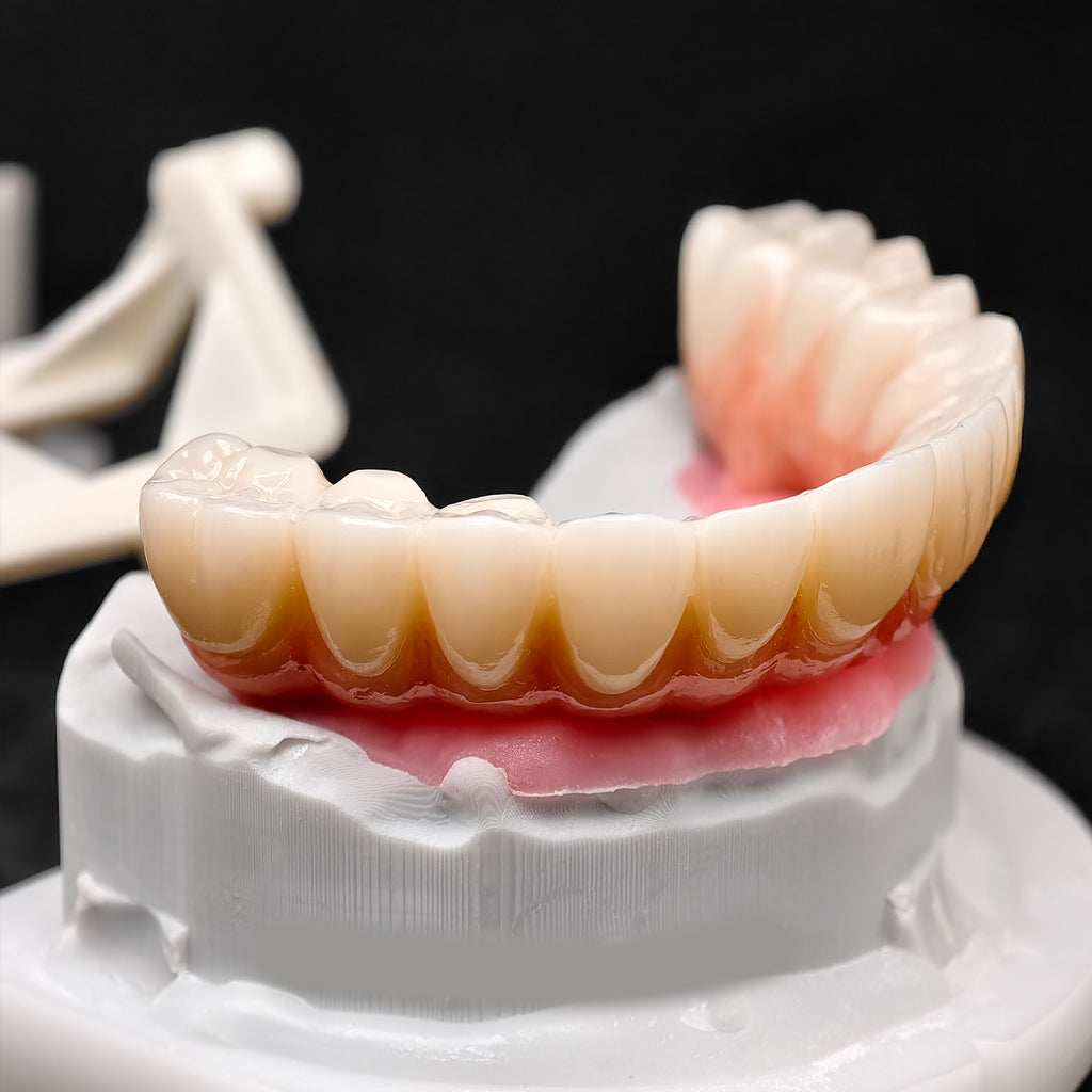 All On 4 Zirconia Bridge With Ti-Base Screw Retained Trying For Full Arch Restoration