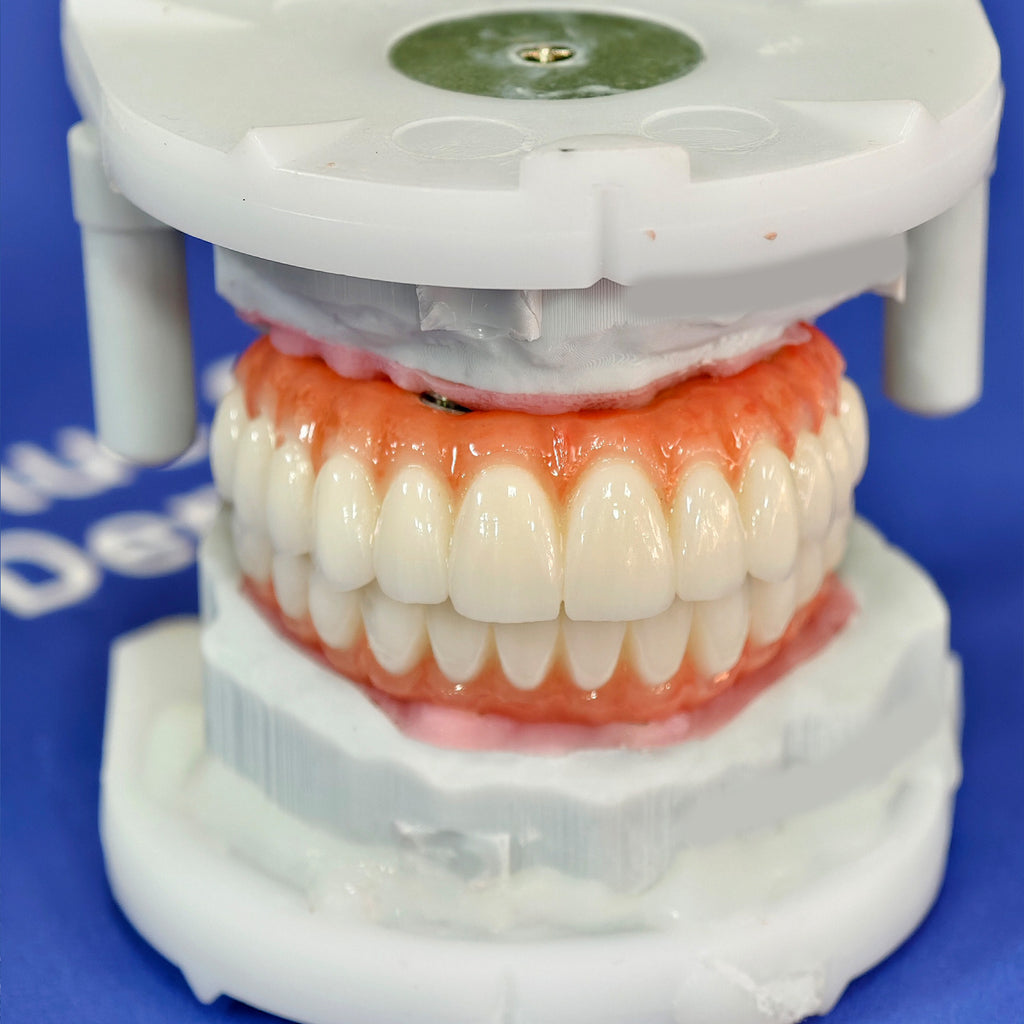 All On 4 Zirconia Bridge With Ti-Base Screw Retained Trying For Full Arch Restoration