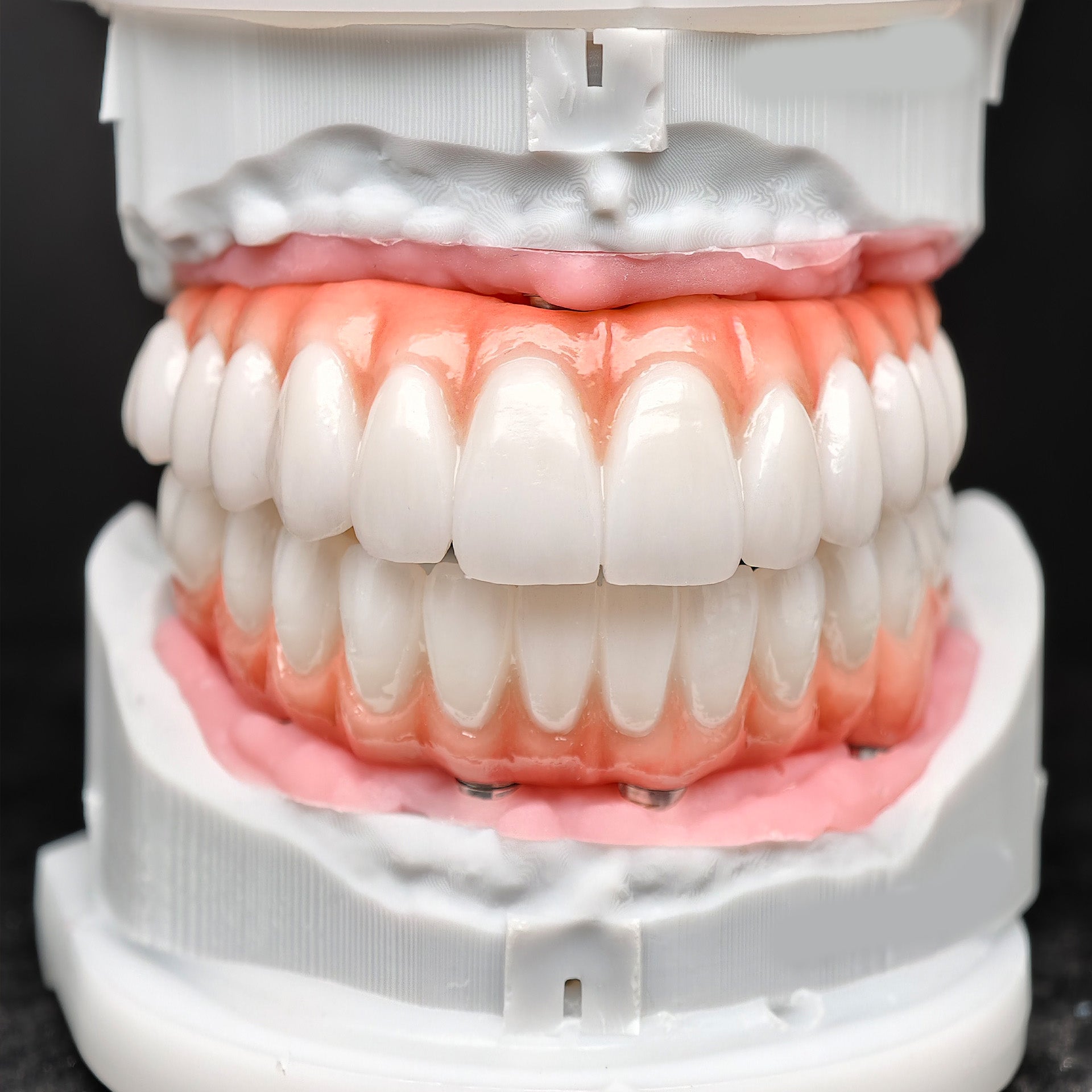All On 5 Zirconia Bridge With Ti-Base Screw Retained Trying For Full Arch Restoration