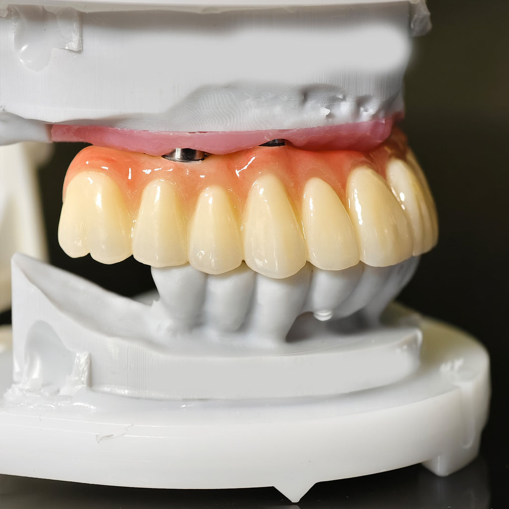 All On 5 Zirconia Bridge With Ti-Base Screw Retained Trying For Full Arch Restoration