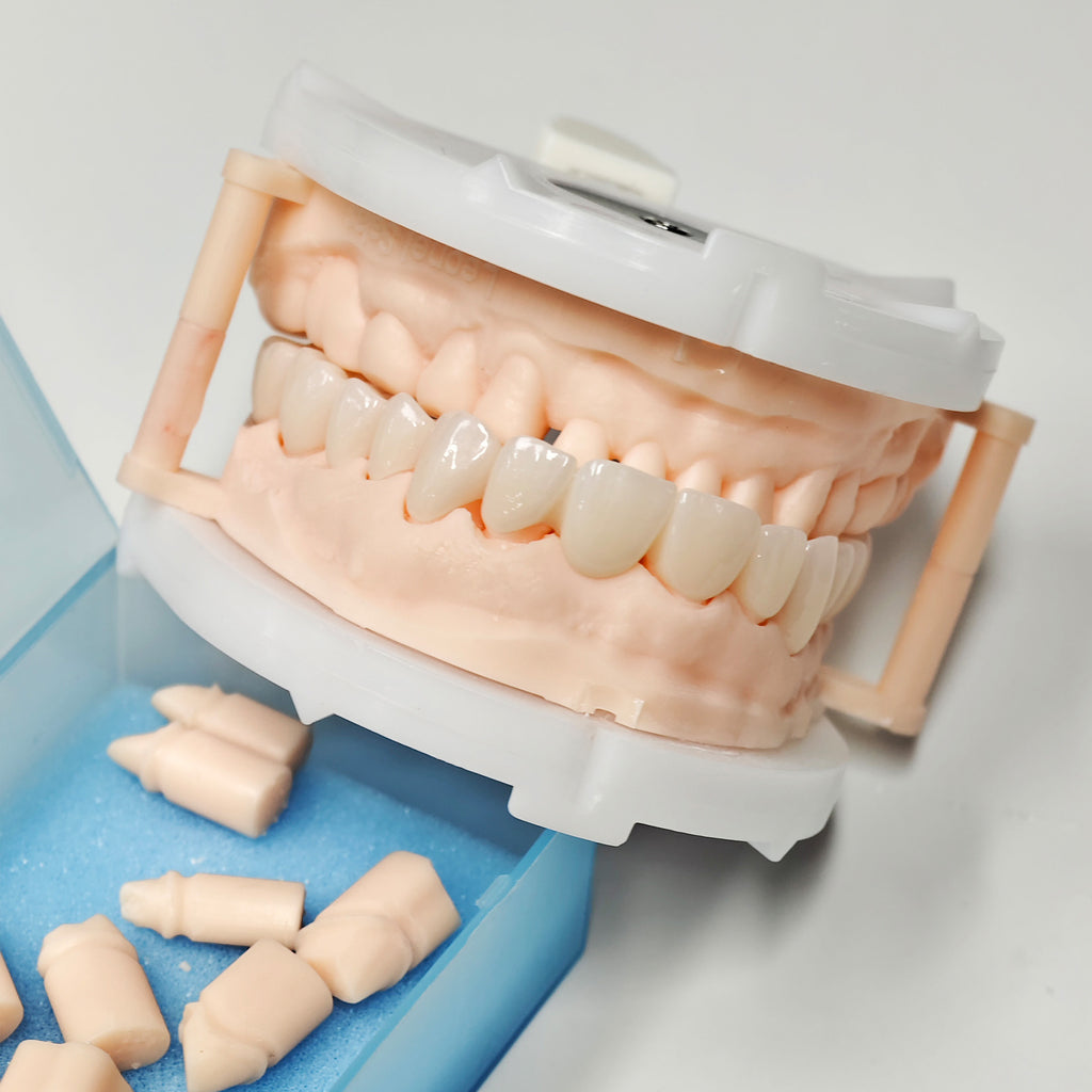 Full-Zriconia Crowns With Cement-Retained