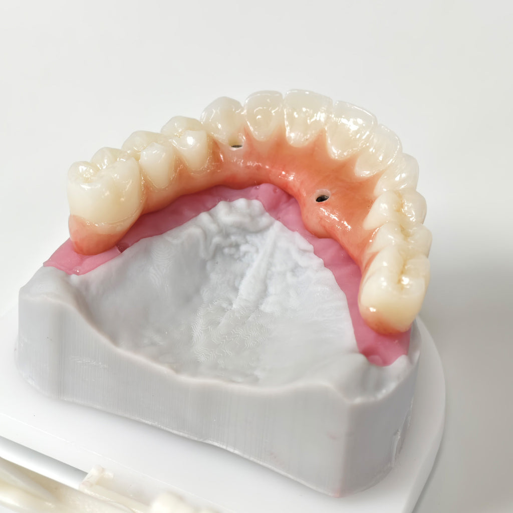 All On 5 Zirconia Bridge With Ti-Base Screw Retained