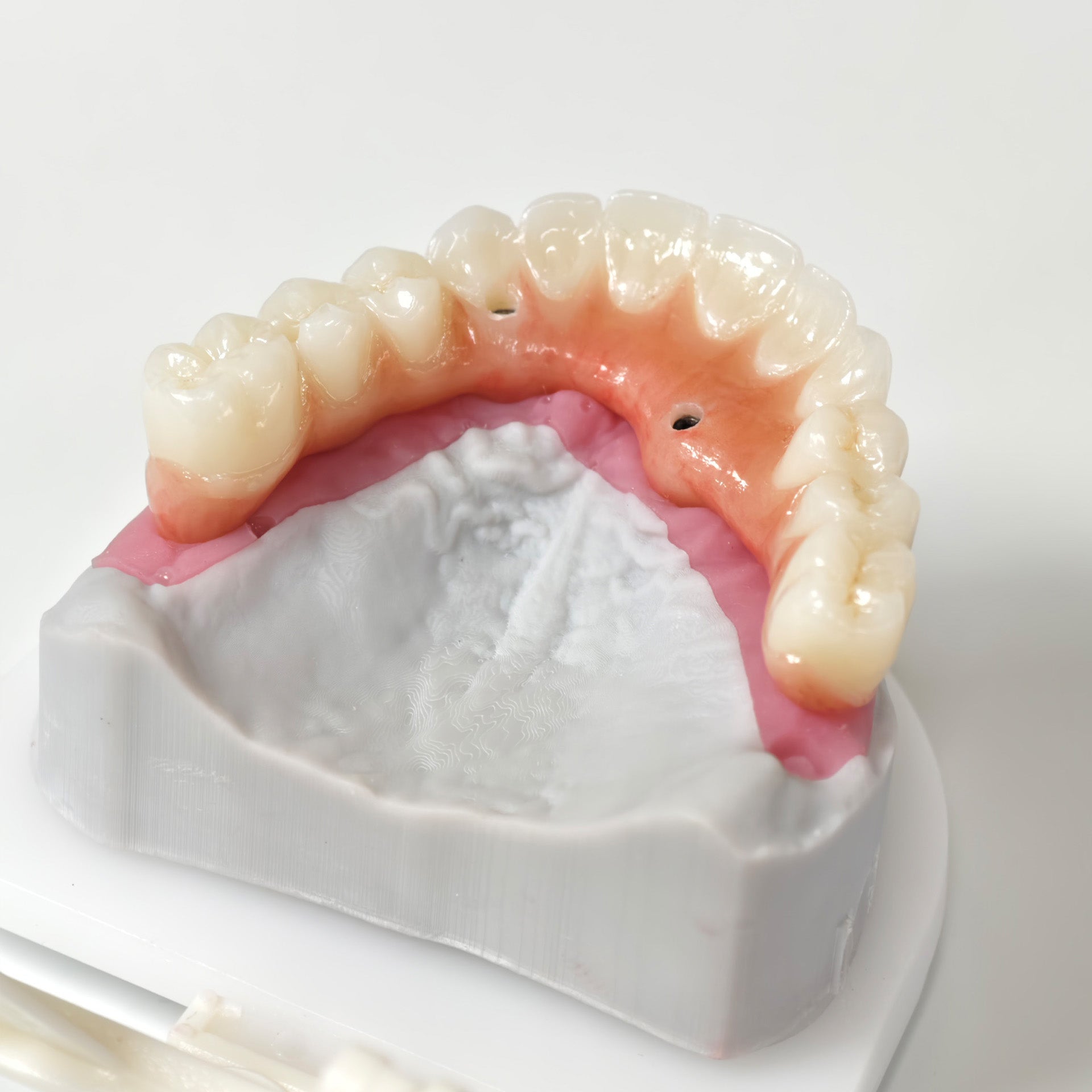 All On 5 Zirconia Bridge With Ti-Base Screw Retained